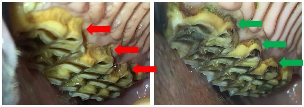 Peripheral caries improvement